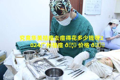 究竟华美祛痘去痘得花多少钱呀2024广州祛痘 🦟 价格 🐟 一览表有啥玄机